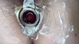 Cute Butt-Sex gaping & tunnel plug. Hairy twat & butthole close-up