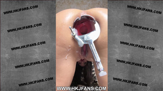 Hotkinkyjo in white bra open her rear-end with XO speculum, self ass-sex fisting & prolapse