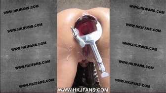 Hotkinkyjo in white bra open her rear-end with XO speculum, self ass-sex fisting & prolapse