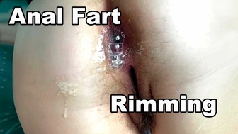 STEPMOM Hairy Rear-End Cunt. Hairy Anus butt sex MATURE MILF. Home-Made Rimjob. Milf Rimming. Hairy Twat Fuck Close Up Cum-Shot
